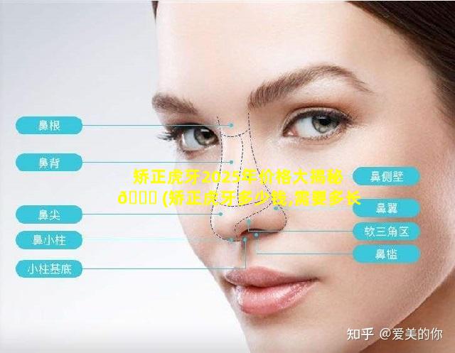 矫正虎牙2025年价格大揭秘 🐎 (矫正虎牙多少钱,需要多长时间)